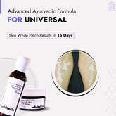 Universal Vitiligo Treatment | Best Natural Ayurvedic Solutions for Universal Vitiligo