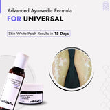 Universal Vitiligo Treatment | Best Natural Ayurvedic Solutions for Universal Vitiligo