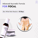 Focal Vitiligo Treatment | Best Natural Ayurvedic Solutions for Focal Vitiligo