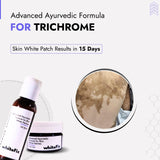 Trichrome Vitiligo Treatment | Best Natural Ayurvedic Solutions for Trichrome Vitiligo