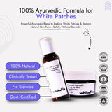 Focal Vitiligo Treatment | Best Natural Ayurvedic Solutions for Focal Vitiligo