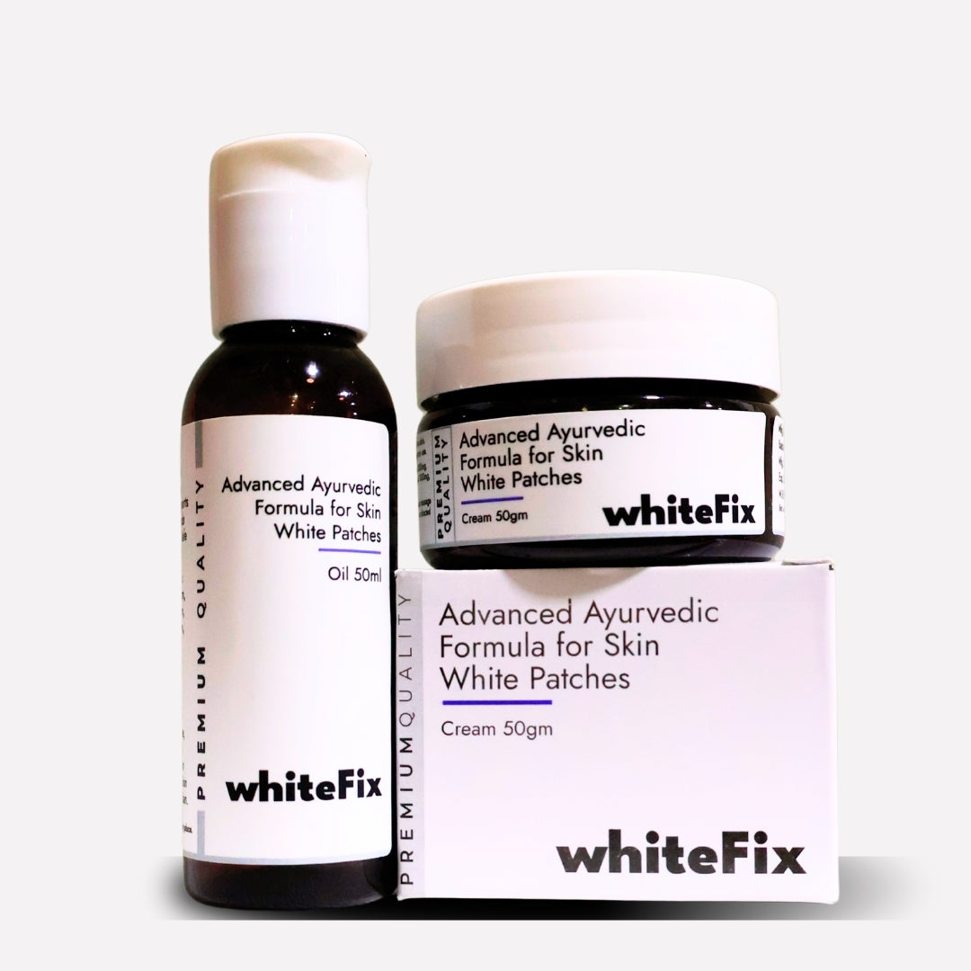 Focal Vitiligo Treatment | Best Natural Ayurvedic Solutions for Focal Vitiligo