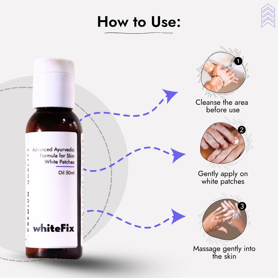 Ayurvedic Natural Oil for Skin White Patches (Vitiligo) - for Day Use