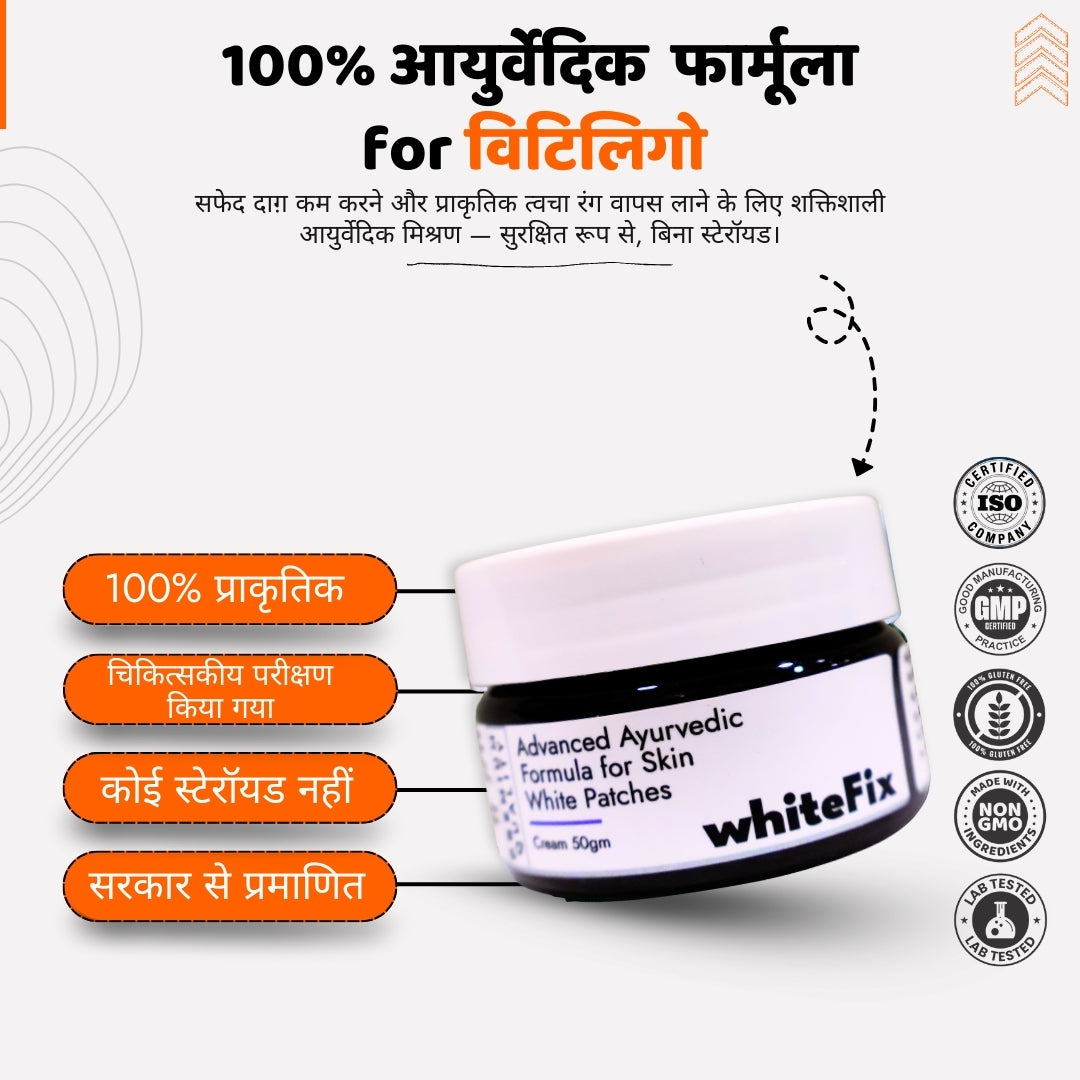 सफेद दाग (विटिलिगो) के लिए आयुर्वेदिक हर्बल क्रीम — रात में उपयोग के लिए