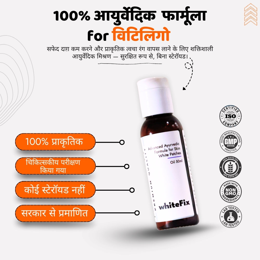 त्वचा के सफेद धब्बों (विटिलिगो) के लिए आयुर्वेदिक प्राकृतिक तेल – दिन के उपयोग हेतु