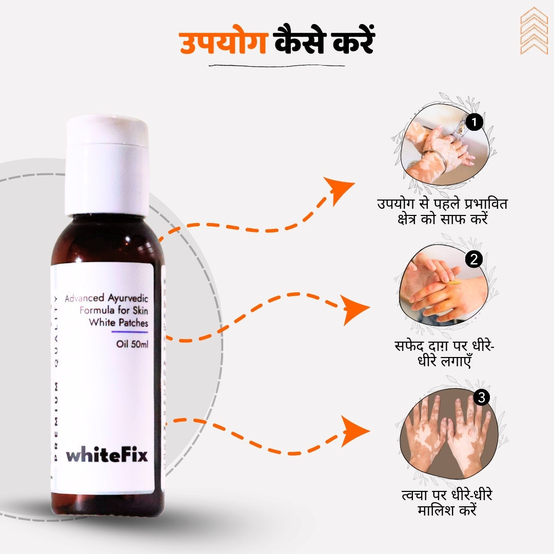 त्वचा के सफेद धब्बों (विटिलिगो) के लिए आयुर्वेदिक प्राकृतिक तेल – दिन के उपयोग हेतु