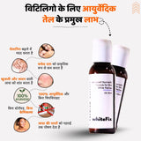 त्वचा के सफेद धब्बों (विटिलिगो) के लिए आयुर्वेदिक प्राकृतिक तेल – दिन के उपयोग हेतु